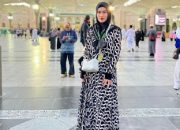 Selebgram Stevie Agnecya Meninggal Dunia di Usia 32